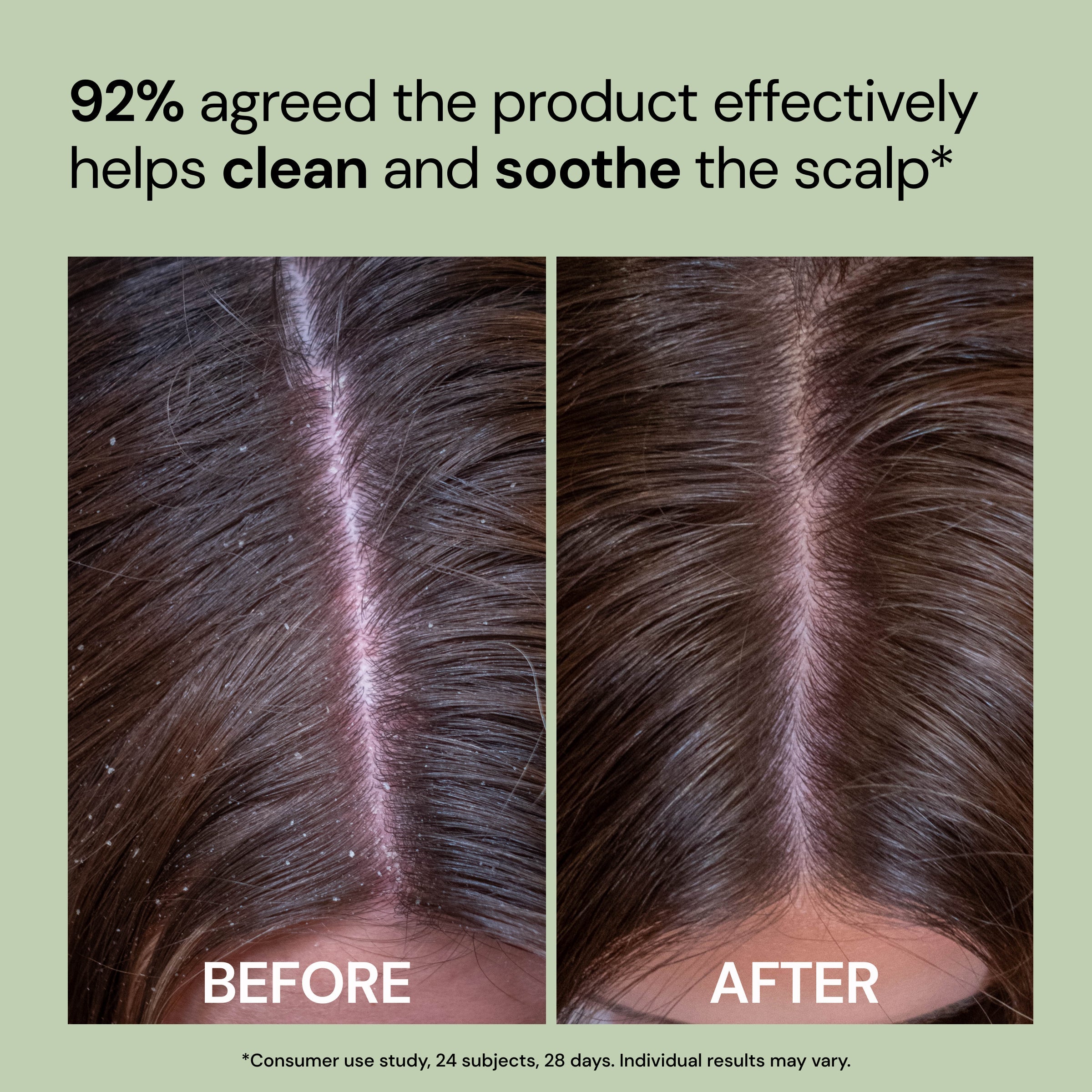 Happy Roots Post-Cleanse Soothing Reset