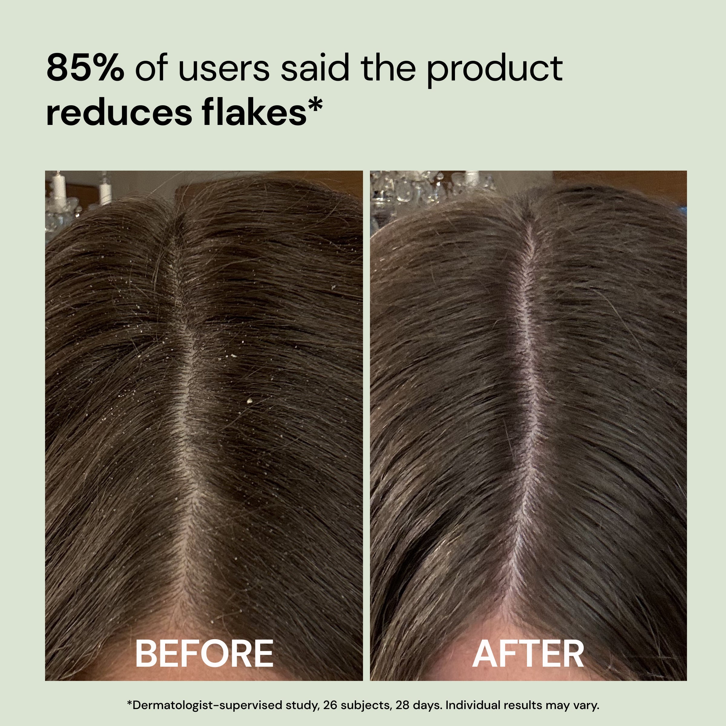 Happy Roots Scalp Calm Serum